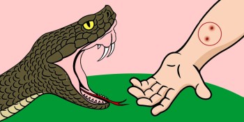 अब स्याङ्जाका अस्पतालबाटै सर्पदंशको उपचार